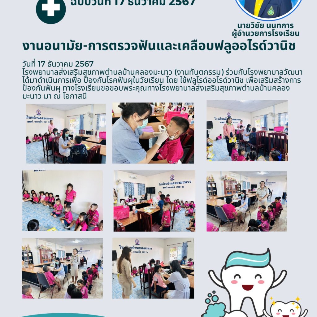 เคลือบฟลูไรด์ออไรด์วานิช เพื่อเสริมสร้างการป้องกันฟันผุ